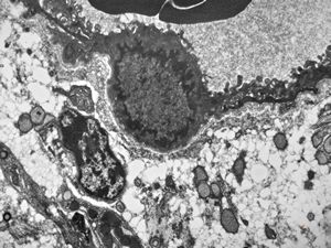 jejunum … lipid malabsorption jejunum … lipid malabsorption